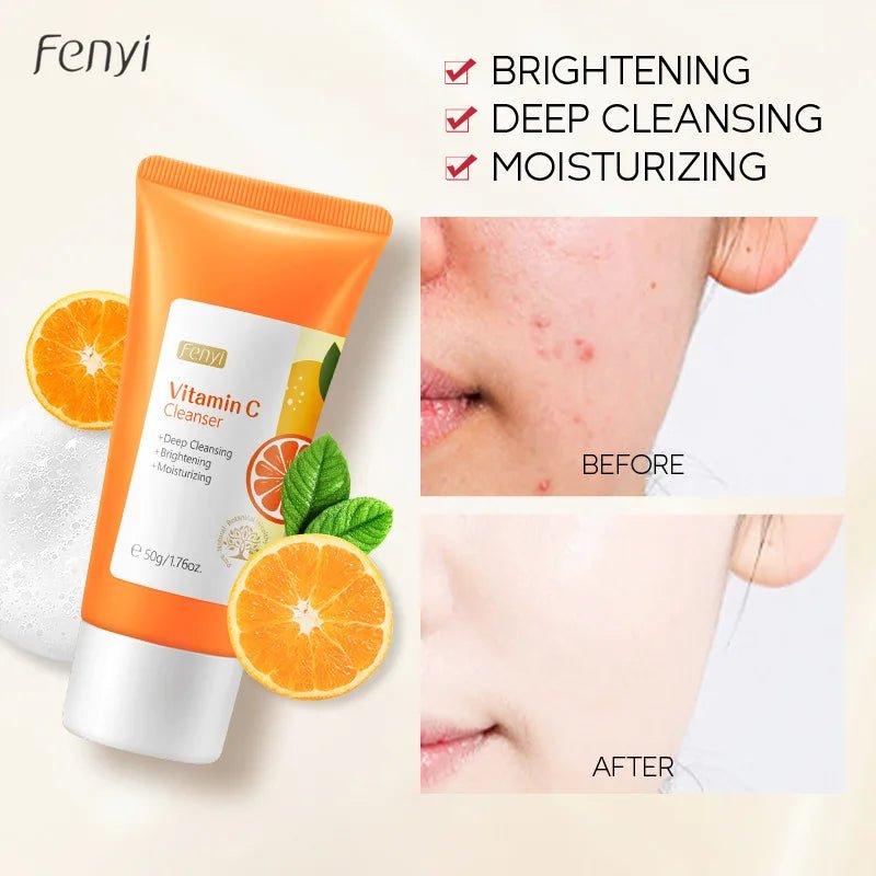 Foaming Face Cleanser Vitamin C | Moisturising, Anti-Acne & Blackheads